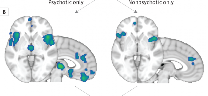 Understanding Brain Mechanisms Of >> Common Brain Mechanisms In Mental Illness Candia Smith Dmh Bcn Understanding Brain Mechanisms Of >> Common Brain Mechanisms In Mental Illness Candia Smith Dmh Bcn